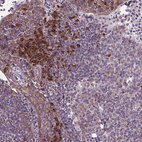 Anti-WDR83OS Antibody