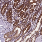 Immunohistochemical staining of human Duodenum shows moderate membranous and cytoplasmic positivity in glandular cells.