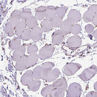 Immunohistochemical staining of human Skeletal muscle shows very weak membranous and cytoplasmic positivity in myocytes.