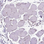 Immunohistochemical staining of human Skeletal muscle shows very weak membranous and cytoplasmic positivity in myocytes.