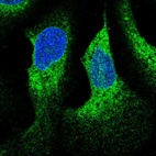 Immunofluorescent staining of human cell line U-2 OS shows localization to nuclear membrane & endoplasmic reticulum.