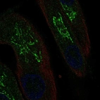 Anti-MAL Antibody