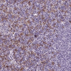 Immunohistochemical staining of human spleen shows moderate cytoplasmic positivity in cells in red pulp.