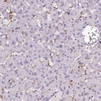 Immunohistochemical staining of human liver shows moderate cytoplasmic positivity in Kupffer cells.