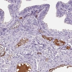 Immunohistochemical staining of human fallopian tube shows moderate positivity in plasma in blood vessels.