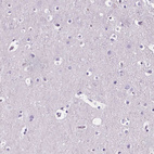 Immunohistochemical staining of human cerebral cortex shows no positivity in neurons as expected.