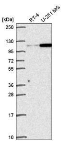 Western blot analysis in human cell line RT-4 and human cell line U-251 MG.