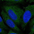 Immunofluorescent staining of human cell line U-2 OS shows localization to endoplasmic reticulum.
