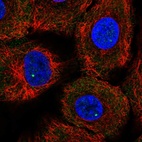 Anti-GEMIN4 Antibody