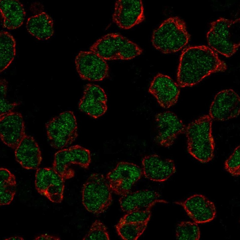 Anti-RAG2 Antibody