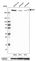 Western blot analysis in U-251MG cells transfected with control siRNA, target specific siRNA probe #1 and #2, using Anti-NES antibody. Remaining relative intensity is presented. Loading control: Anti-GAPDH.