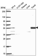 Anti-TTC39C Antibody