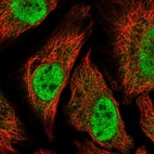 Immunofluorescent staining of human cell line HeLa shows localization to nucleoplasm.