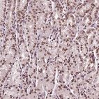 Anti-TTC39C Antibody