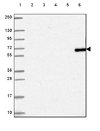 Lane 1: Marker [kDa] 250, 130, 95, 72, 55, 36, 28, 17, 10_br/_Lane 2: Human cell line RT-4_br/_Lane 3: Human cell line U-251 MG_br/_Lane 4: Human plasma_br/_Lane 5: Human Liver tissue_br/_Lane 6: Human Tonsil tissue