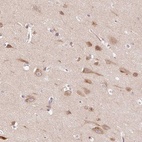 Immunohistochemical staining of human cerebral cortex shows high expression.