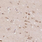 Immunohistochemical staining of human cerebral cortex shows high expression.