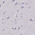 Immunohistochemical staining of human cerebral cortex using Anti-HIST1H1T antibody HPA065718.