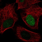 Immunofluorescent staining of human cell line U-2 OS shows localization to nucleus.