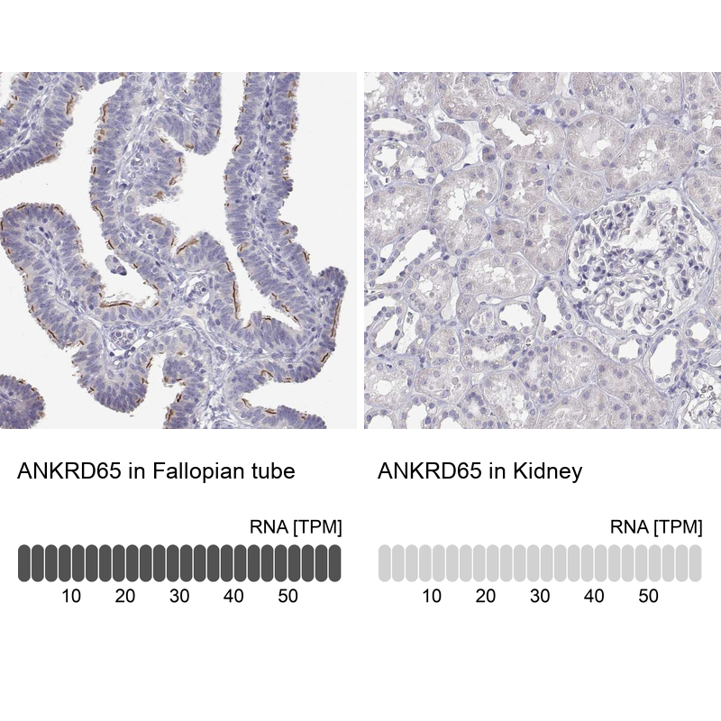 Anti-ANKRD65 Antibody