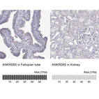 Anti-ANKRD65 Antibody