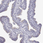 Immunohistochemical staining of human fallopian tube shows high expression.