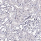 Immunohistochemical staining of human kidney shows low expression as expected.
