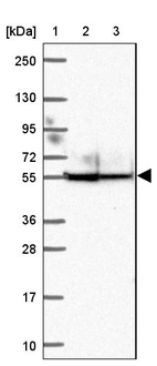 Lane 1: Marker [kDa] 250, 130, 95, 72, 55, 36, 28, 17, 10_br/_Lane 2: Human cell line RT-4_br/_Lane 3: Human cell line U-251 MG