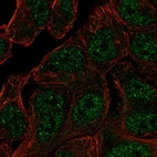 Immunofluorescent staining of human cell line RT4 shows localization to nucleoplasm.