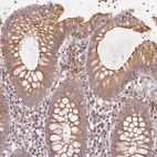 Anti-KLHL15 Antibody