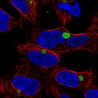 Immunofluorescent staining of human cell line HEK 293 shows localization to aggresome.
