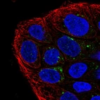 Immunofluorescent staining of human cell line RT4 shows localization to the Golgi apparatus.