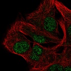Immunofluorescent staining of human cell line SK-MEL-30 shows localization to nucleoplasm.