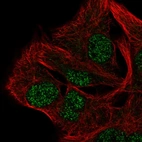 Immunofluorescent staining of human cell line SK-MEL-30 shows localization to nucleoplasm.