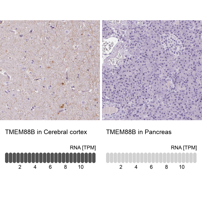 Anti-TMEM88B Antibody