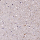 Immunohistochemical staining of human cerebral cortex shows high expression.