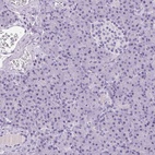 Anti-TMEM88B Antibody
