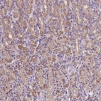 Anti-MKRN2OS Antibody