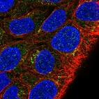 Immunofluorescent staining of human cell line RT4 shows localization to the Golgi apparatus.