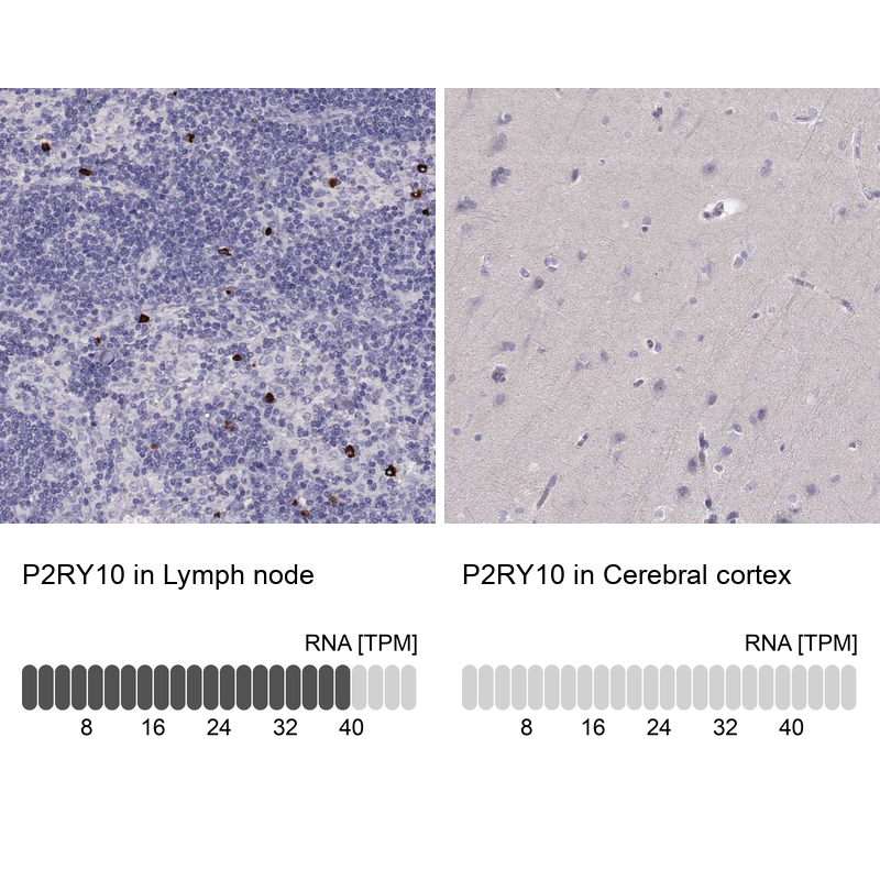 Anti-P2RY10 Antibody