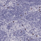 Immunohistochemical staining of human lymph node shows high expression.