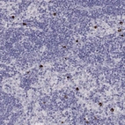 Immunohistochemical staining of human lymph node shows high expression.