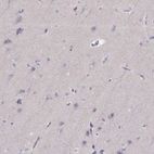 Immunohistochemical staining of human cerebral cortex shows low expression as expected.