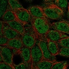 Anti-ATOH1 Antibody
