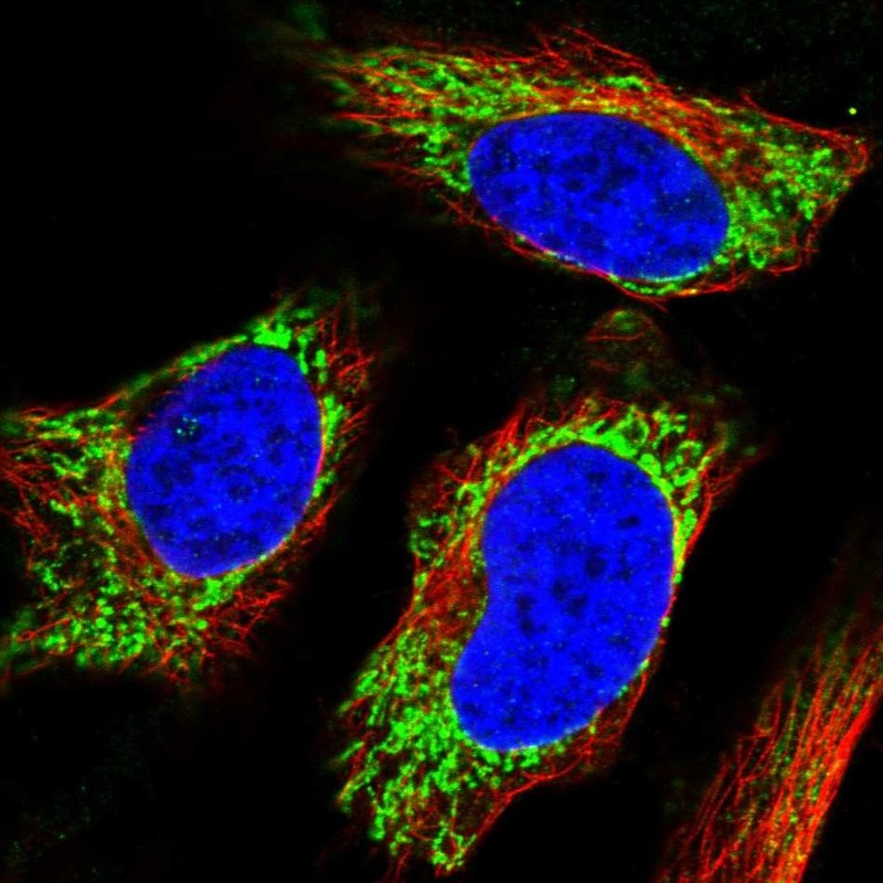 Anti-UGT8 Antibody