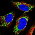 Anti-UGT8 Antibody