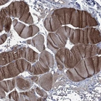 Immunohistochemical staining of human skeletal muscle shows high expression.