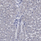 Anti-OBSCN Antibody