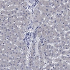 Immunohistochemical staining of human liver shows low expression as expected.
