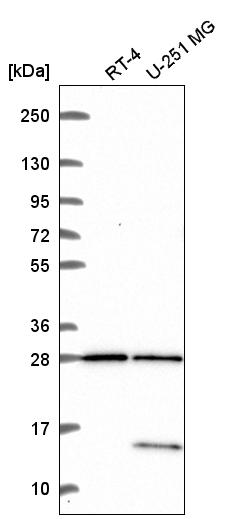 Anti-TBC1D16 Antibody